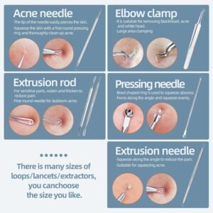 JPNK Blackhead Remover Kit Review